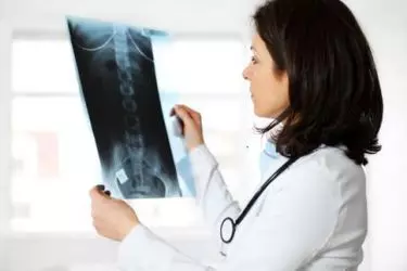 best hospital for stroke treatment in Katihar, best doctor for stroke treatment in Katihar, cost of stroke treatment in Katihar