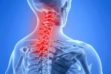 best hospital for cervical spondylitis treatment in Katihar, best doctor for cervical spondylitis treatmen in Katihar, cost of cervical spondylitis treatmen in Katihar