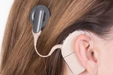 best hospital for cochlear implant surgery in Katihar, best doctor for cochlear implant surgery in Katihar, cost of cochlear implant surgery in Katihar