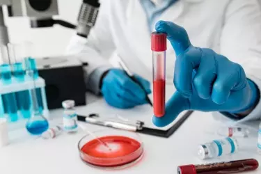 best pathology lab in Katihar, best lab for blood test in Katihar, best nabl lab in Katihar
